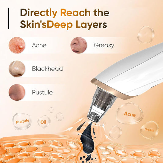 Premium Electric Face Vacuum Blackhead Remover Deep Pore Cleansing Tool